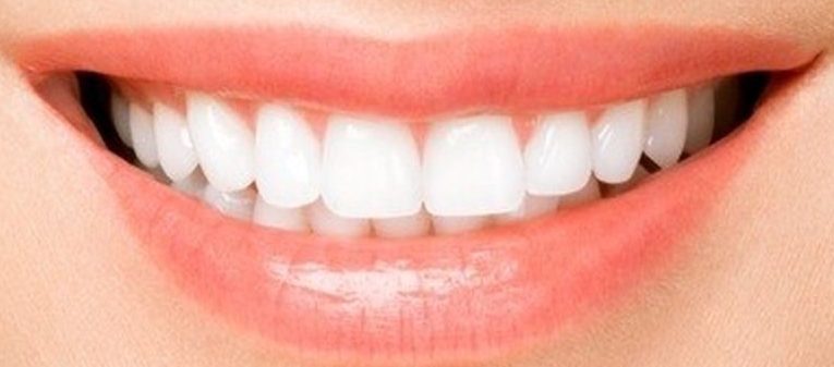 Sourire naturel avec dents de prothèse dentaire type céramique